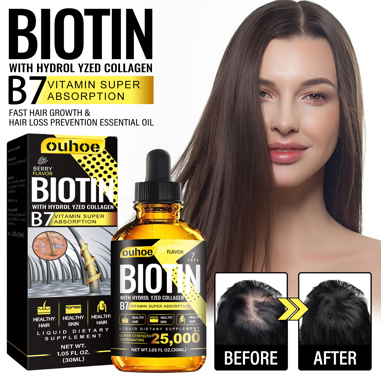 OUHOE 胶原蛋白B7维生素头发精油 固发密发防掉发护发精油